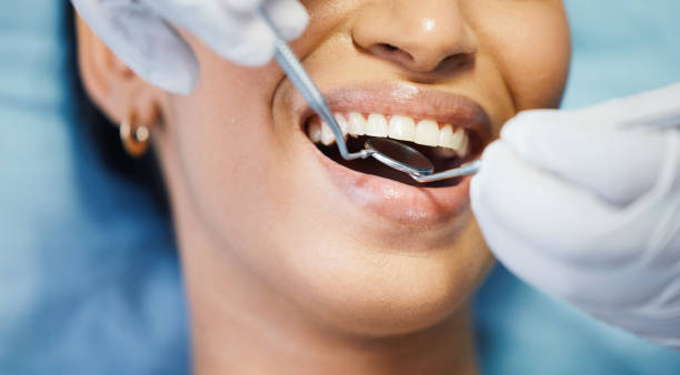 Best Emergency Treatment for Dental Infections or Abscesses in Lake Oswego, OR